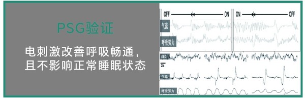 PSG验证